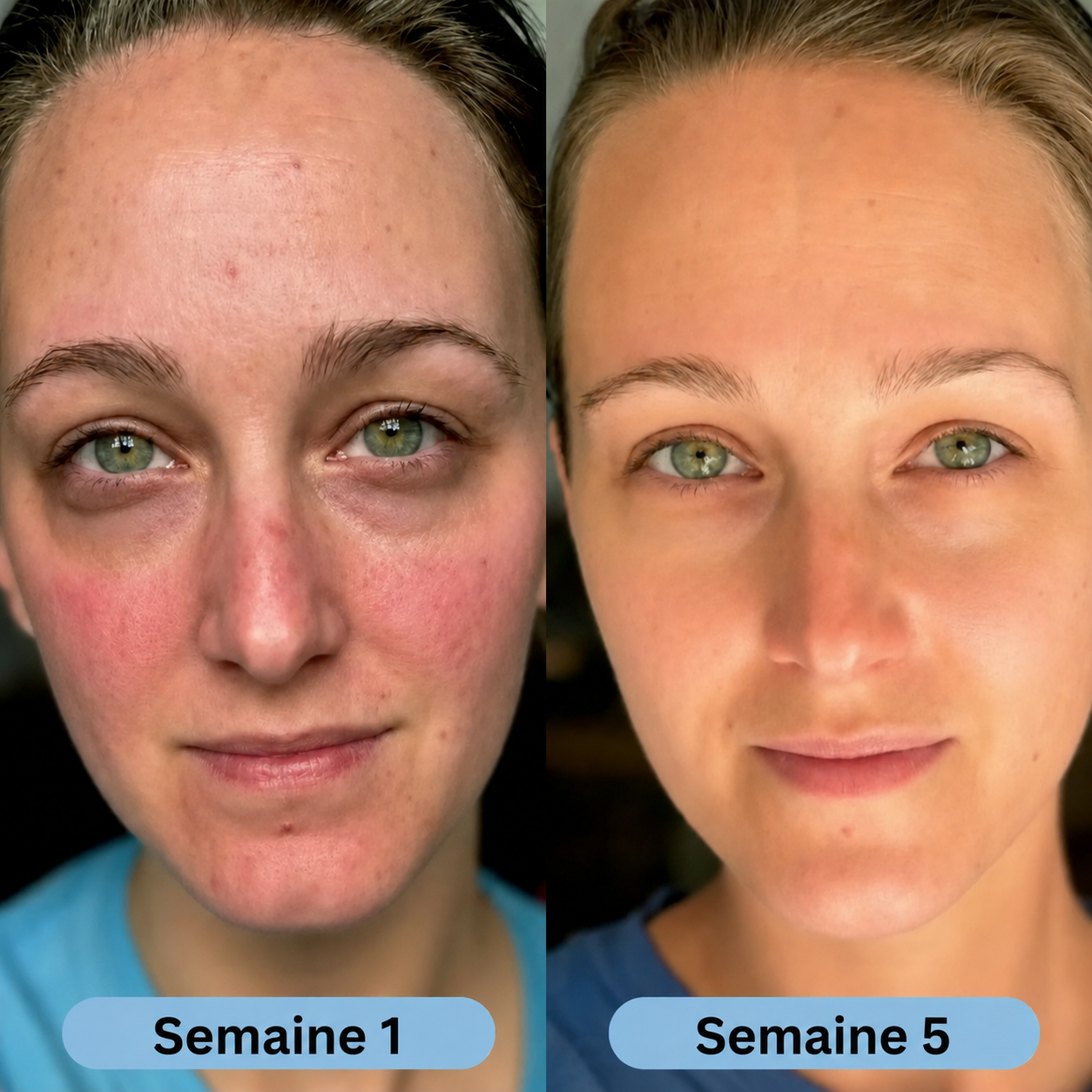 Volufine | Sérum coréen pour peaux matures