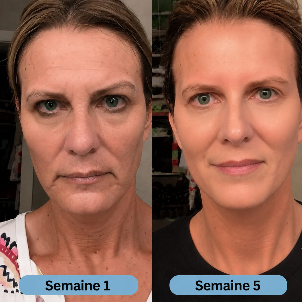 Volufine | Sérum coréen pour peaux matures