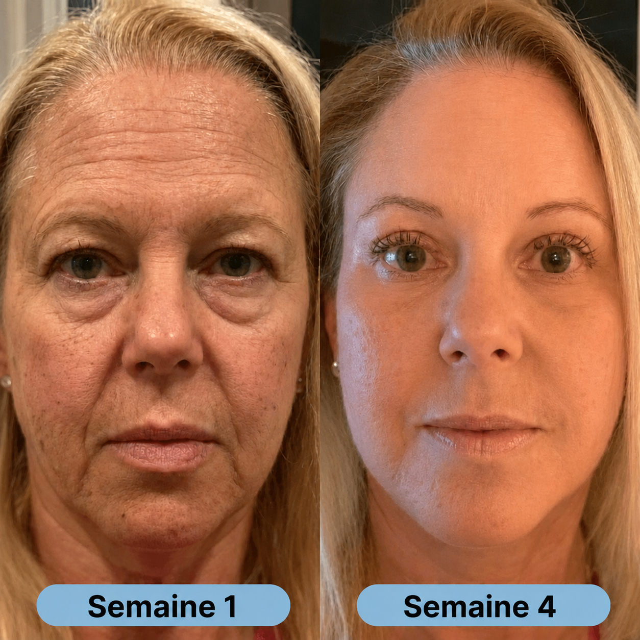 Volufine | Sérum coréen pour peaux matures